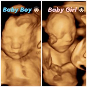 19 week 4d ultrasound pictures